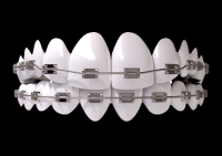 dentes-aparelho-001